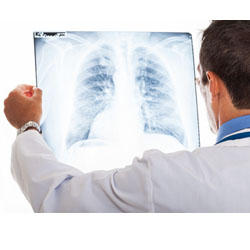 ⇒ Asbestose trouvez des réponses à vos questions